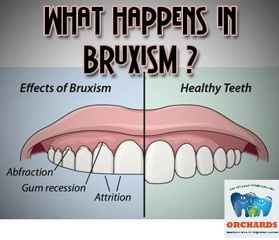 bruxism