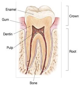 Cracked Tooth