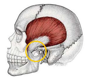 Jaw Joint Problems1