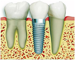 Dental Scrope